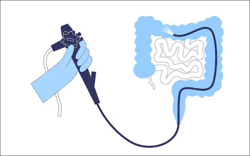 Nội soi là một trong những phương pháp chẩn đoán bệnh hữu hiệu