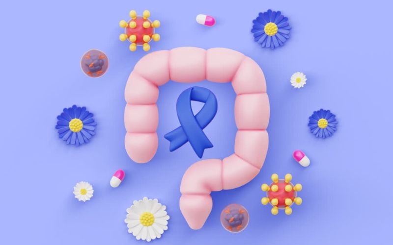 Điều trị viêm đại tràng cần điều trị theo đúng tác nhân gây bệnh