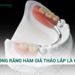 Vệ sinh hàm giả mỗi ngày bằng bàn chải mềm và dung dịch chuyên dụng