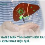 Bài viết này từ Docosan sẽ cung cấp thông tin chi tiết về nguyên nhân, triệu chứng, cách chẩn đoán và các phương pháp điều trị viêm gan b mãn tính hiện nay