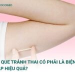 Cấy que tránh thai có phải là biện pháp hiệu quả? Quy trình và lưu ý