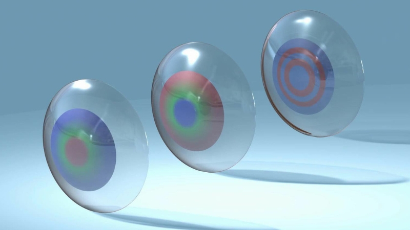 Mổ cườm mắt đa tiêu cự giúp thay thế kính thuốc, hồi phục thị lực cho người đục thủy tinh thể