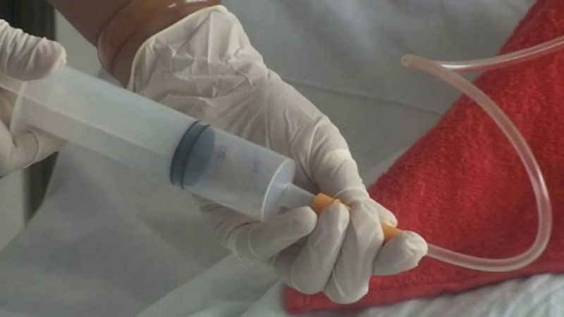 Đặt sonde dạ dày là một phương pháp để truyền thức ăn, thăm khám, điều trị cho hầu hết các bệnh nhân hôn mê