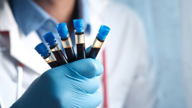 Tests help the doctor gain a deeper insight into your internal health markers