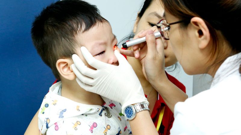 Chi phí khám mắt cho trẻ em không có một con số cố định