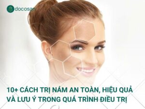 10+ cách trị nám an toàn, hiệu quả và lưu ý trong quá trình điều trị