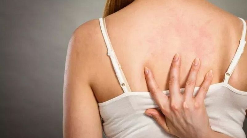 Bạn nên chia sẻ chính xác tình trạng da mình gặp phải khi đi khám da liễu 