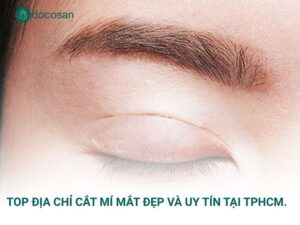 Top địa chỉ cắt mí mắt đẹp và uy tín tại TPHCM