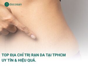 Top địa chỉ trị rạn da tại TPHCM uy tín & hiệu quả