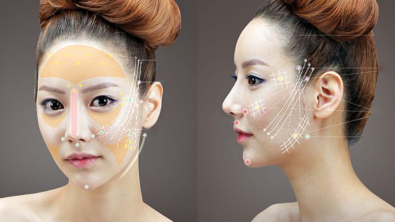 Căng da mặt bằng chỉ là một phương pháp thẩm mỹ nội khoa không phẫu thuật