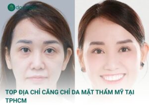 Top địa chỉ căng chỉ da mặt thẩm mỹ tại TPHCM