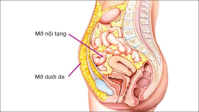 Mỡ bụng gồm 2 loại là mỡ nội tạng và mỡ dưới da