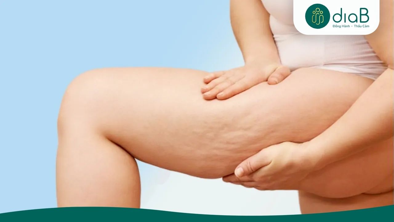 Mỡ ở các khu vực này thường là mỡ lâu năm, cấu trúc bền vững nên khó phân hủy hơn
