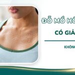 Đổ mồ hôi nhiều có giảm cân không?