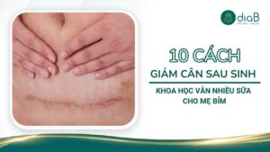 10 Cách giảm cân sau sinh mổ khoa học vẫn nhiều sữa cho mẹ bim