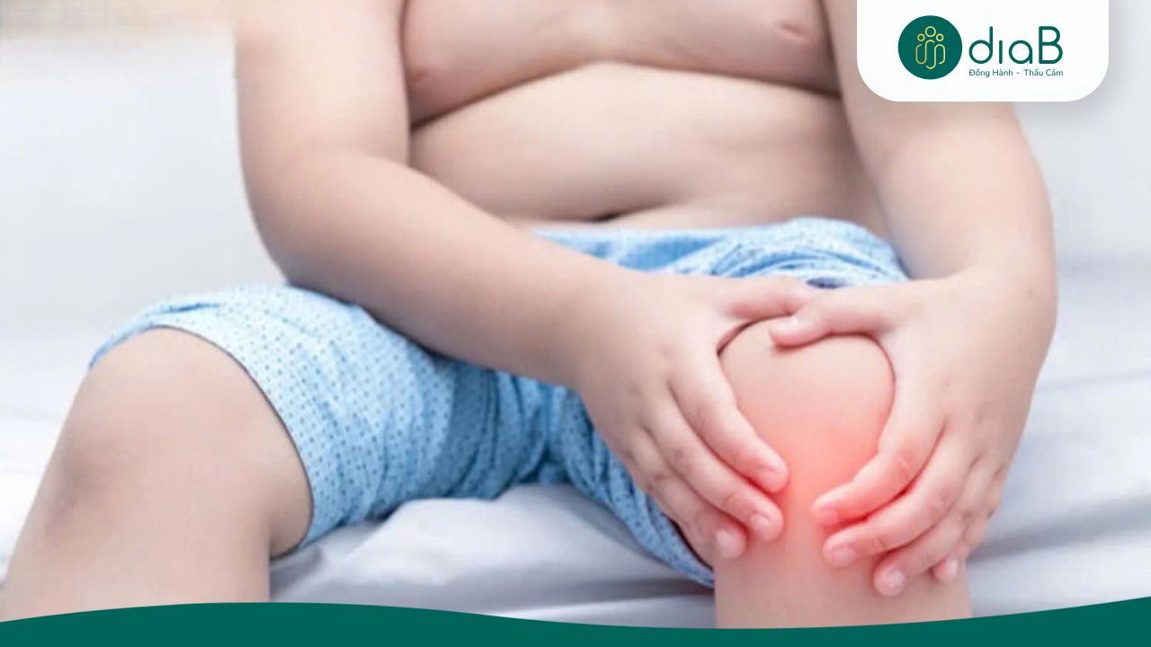 Trọng lượng cơ thể lớn làm tăng áp lực cơ học lên các khớp chịu lực (Nguồn: Internet)