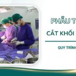 Phẫu thuật cắt khối tá tụy: Quy trình và lưu ý quan trọng