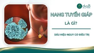 Nang tuyến giáp là gì? Dấu hiệu, nguy cơ và cách điều trị