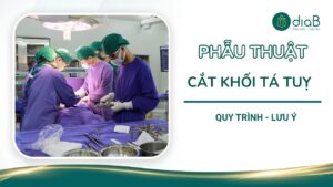 Phẫu thuật cắt khối tá tụy: Quy trình và lưu ý quan trọng