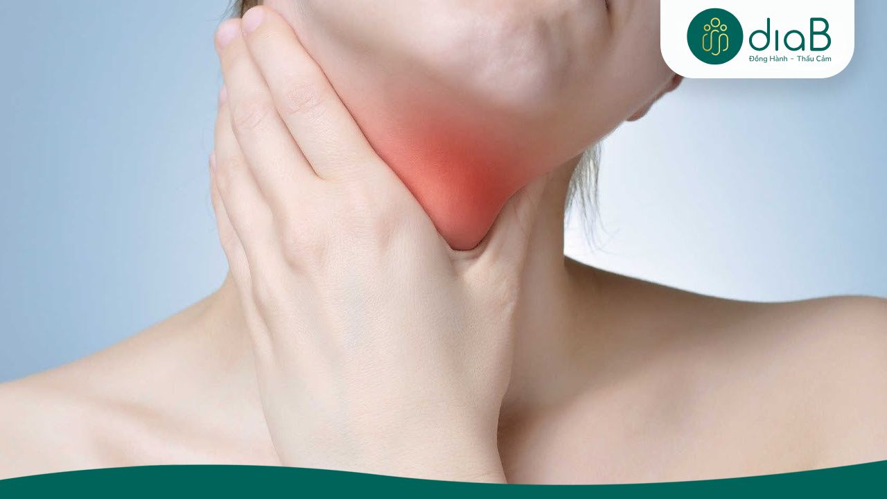Nang tuyến giáp lành tính cần được theo dõi định kỳ