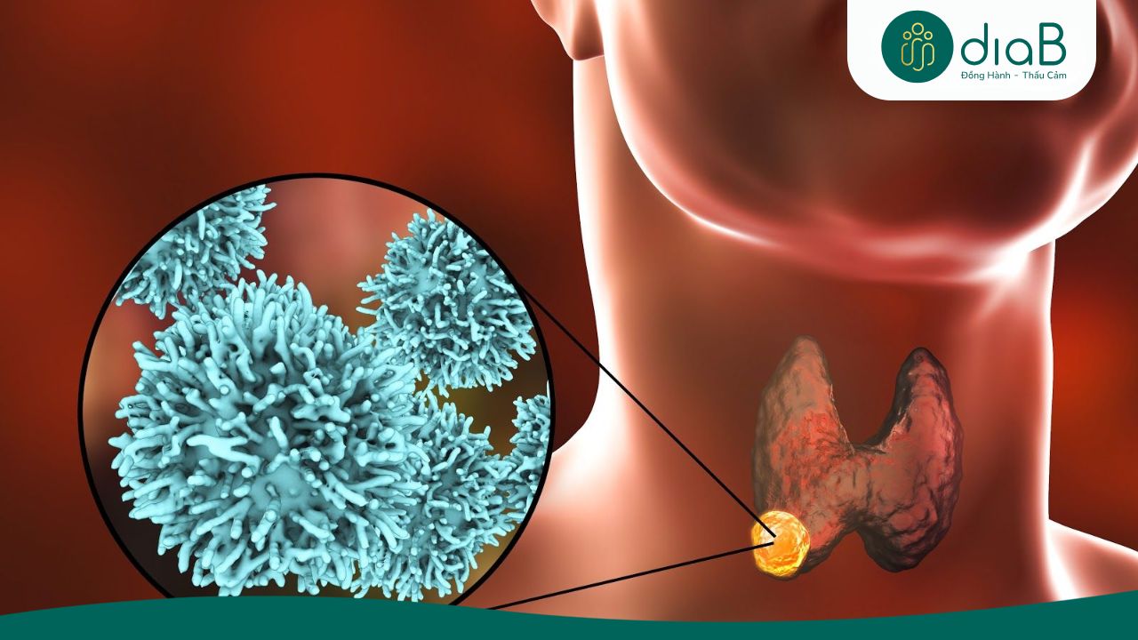Đánh giá cấu trúc nhu mô tuyến giáp trên hình ảnh siêu âm