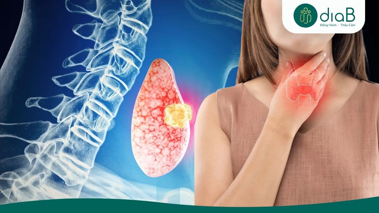 Phần lớn nang tuyến giáp lành tính