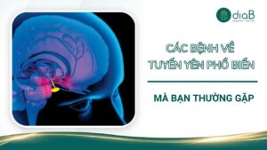 Các bệnh về tuyến yên phổ biến mà bạn thường gặp