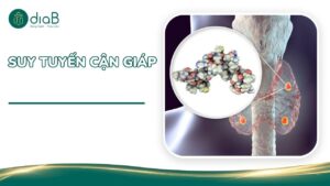 suy tuyến cận giáp
