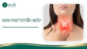 ung thư tuyến giáp
