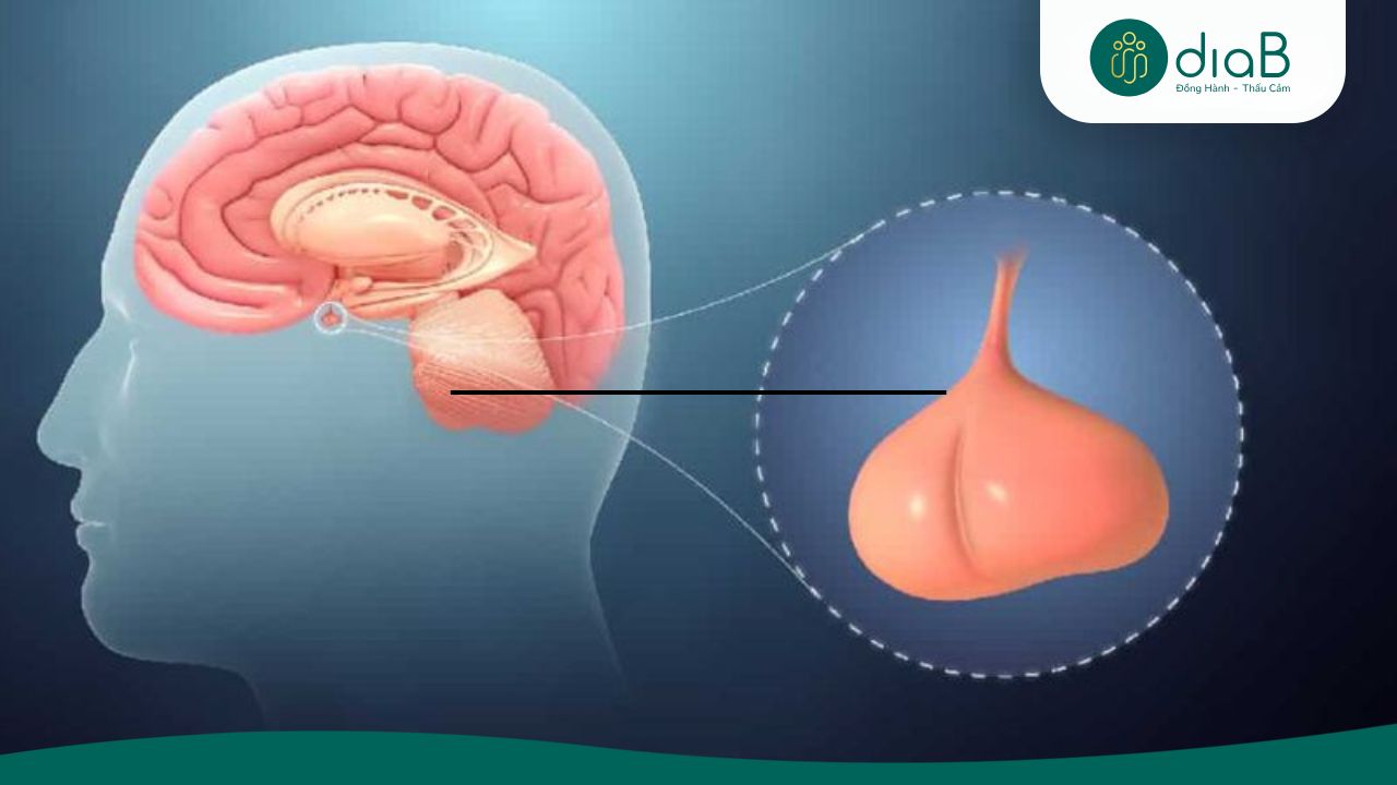 Rối loạn tuyến yên gây biến chứng nghiêm trọng nếu không điều trị kịp thời (Nguồn: Internet)
